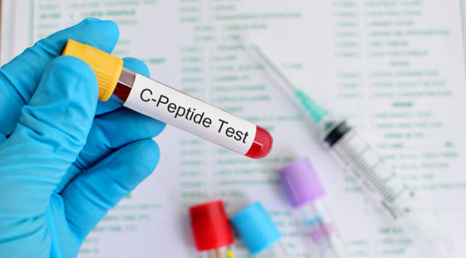 C peptid vizsgálat döntő lehet! | Gellért Labor - Vérvétel Budapesten, magánlabor a Gellért téren